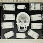 A radiographer’s look at the skull – and those things so often attached to it.